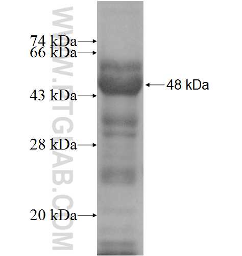 GGCX fusion protein Ag9261 SDS-PAGE GGCX fusion protein Ag9261 SDS-PAGE