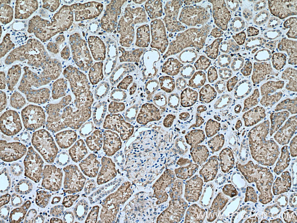 IHC staining of human kidney using 13264-1-AP