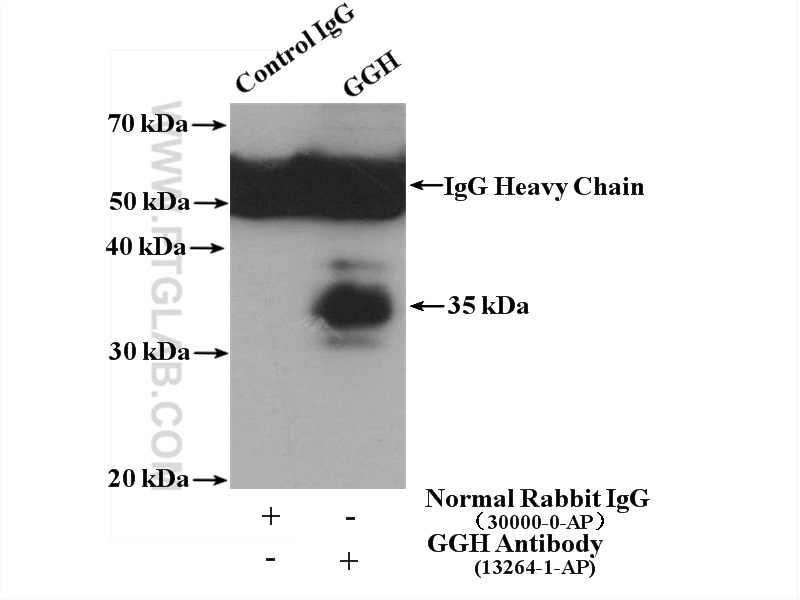 IP experiment of HepG2 using 13264-1-AP