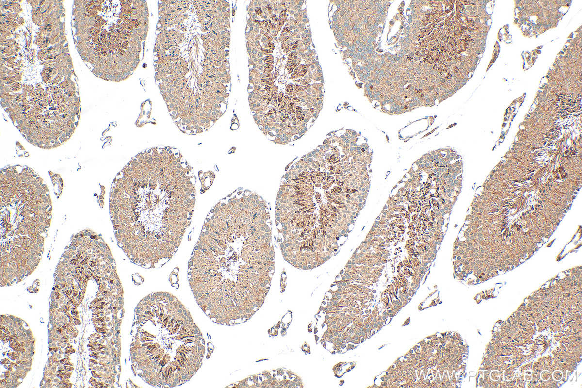 IHC staining of mouse testis using 18850-1-AP