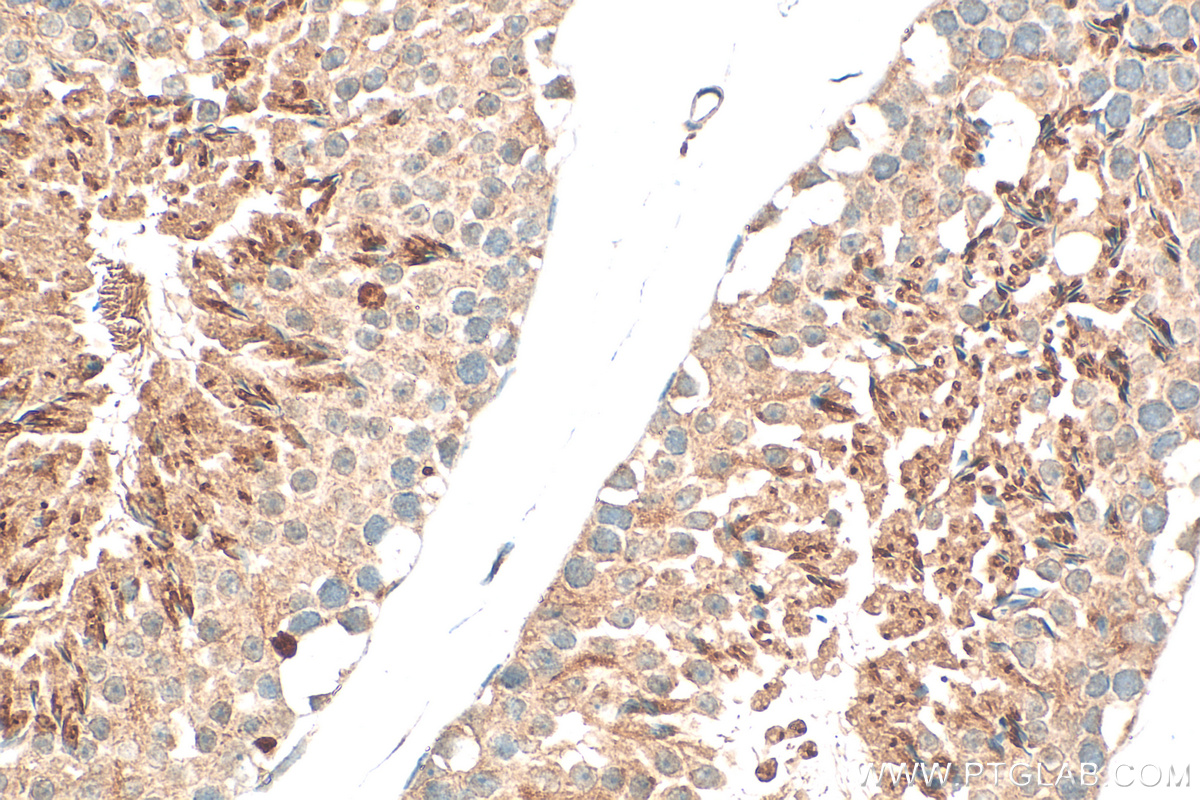 IHC staining of mouse testis using 18850-1-AP