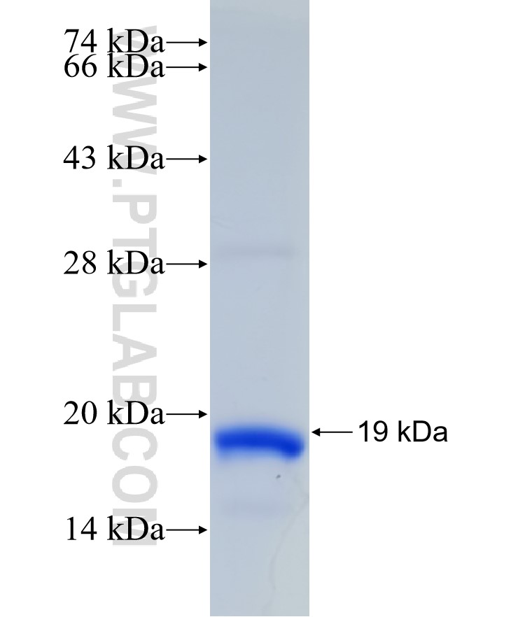 GGPS1 fusion protein Ag31490 SDS-PAGE GGPS1 fusion protein Ag31490 SDS-PAGE