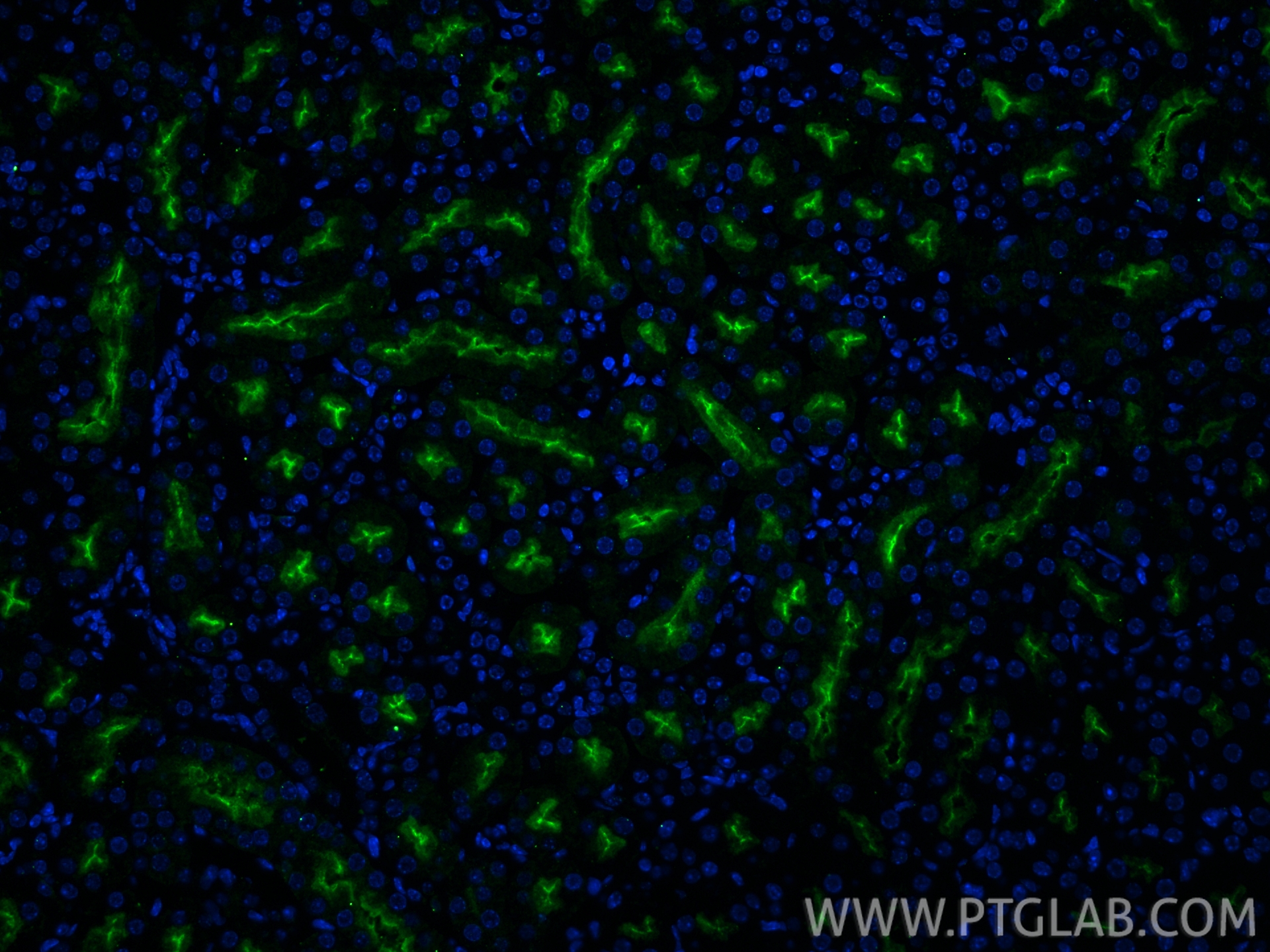 IF Staining of mouse kidney using 33389-1-AP