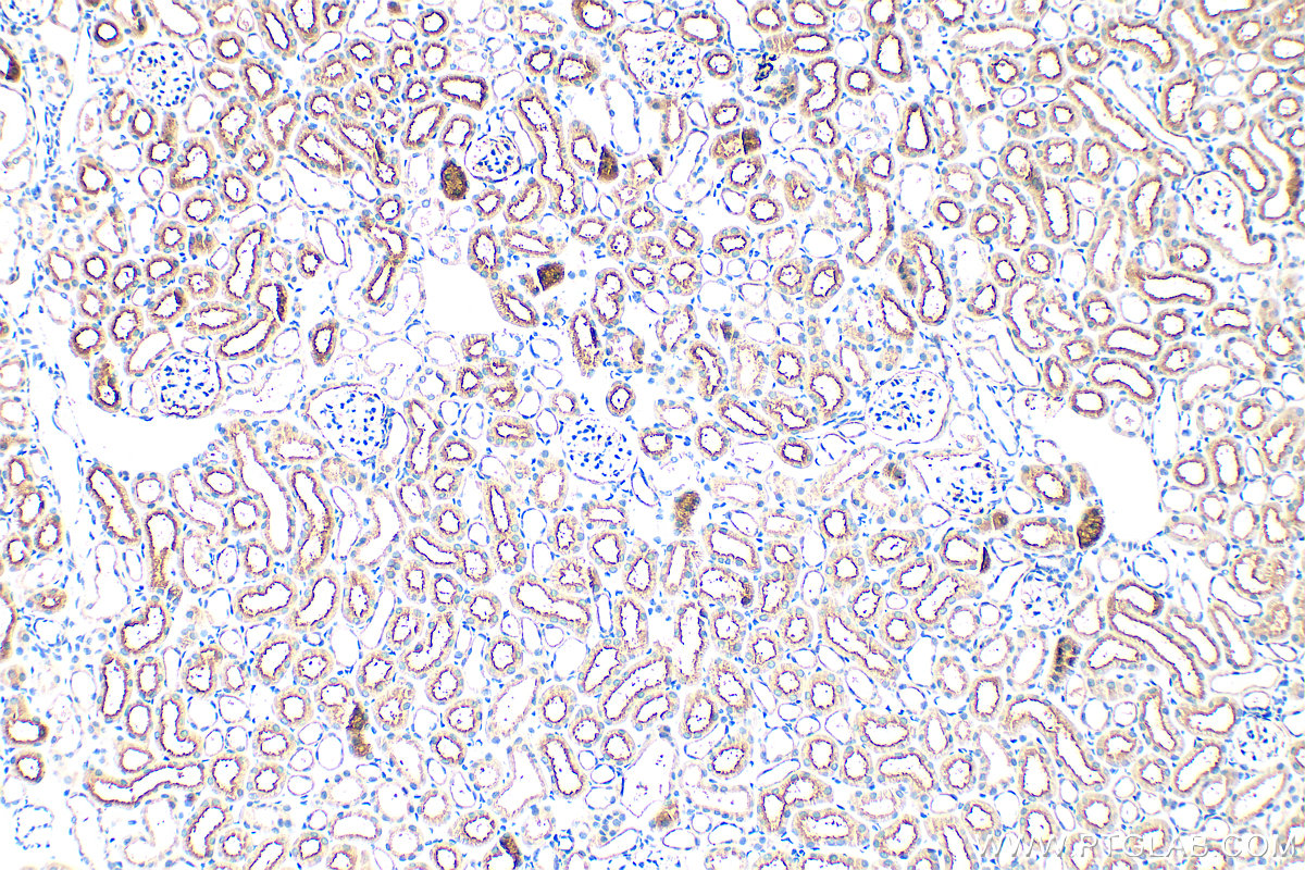 IHC staining of mouse kidney using 33389-1-AP