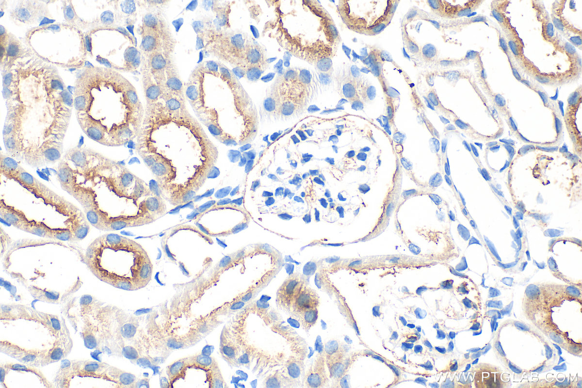 IHC staining of mouse kidney using 33389-1-AP