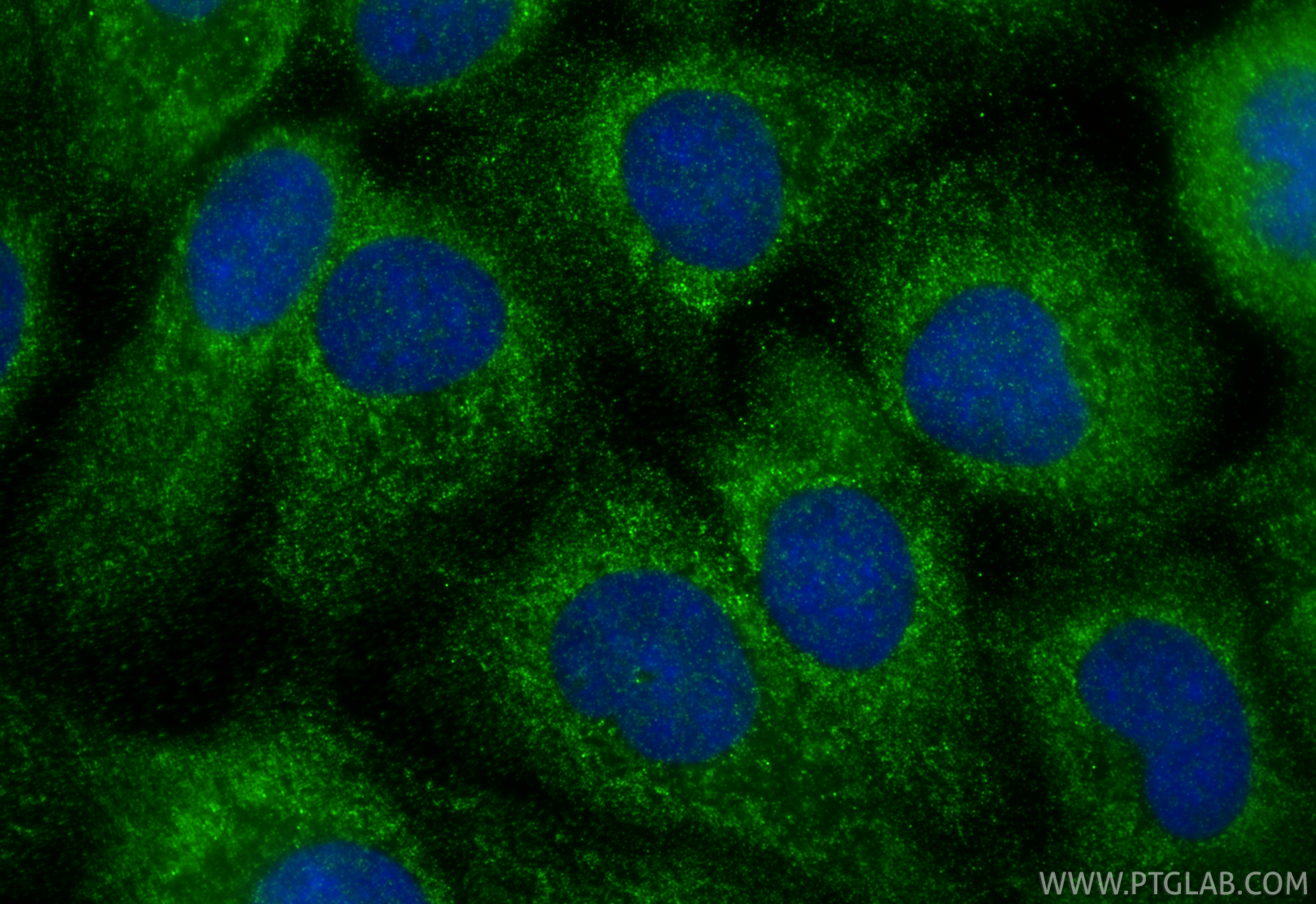 IF Staining of A431 using 33436-1-AP