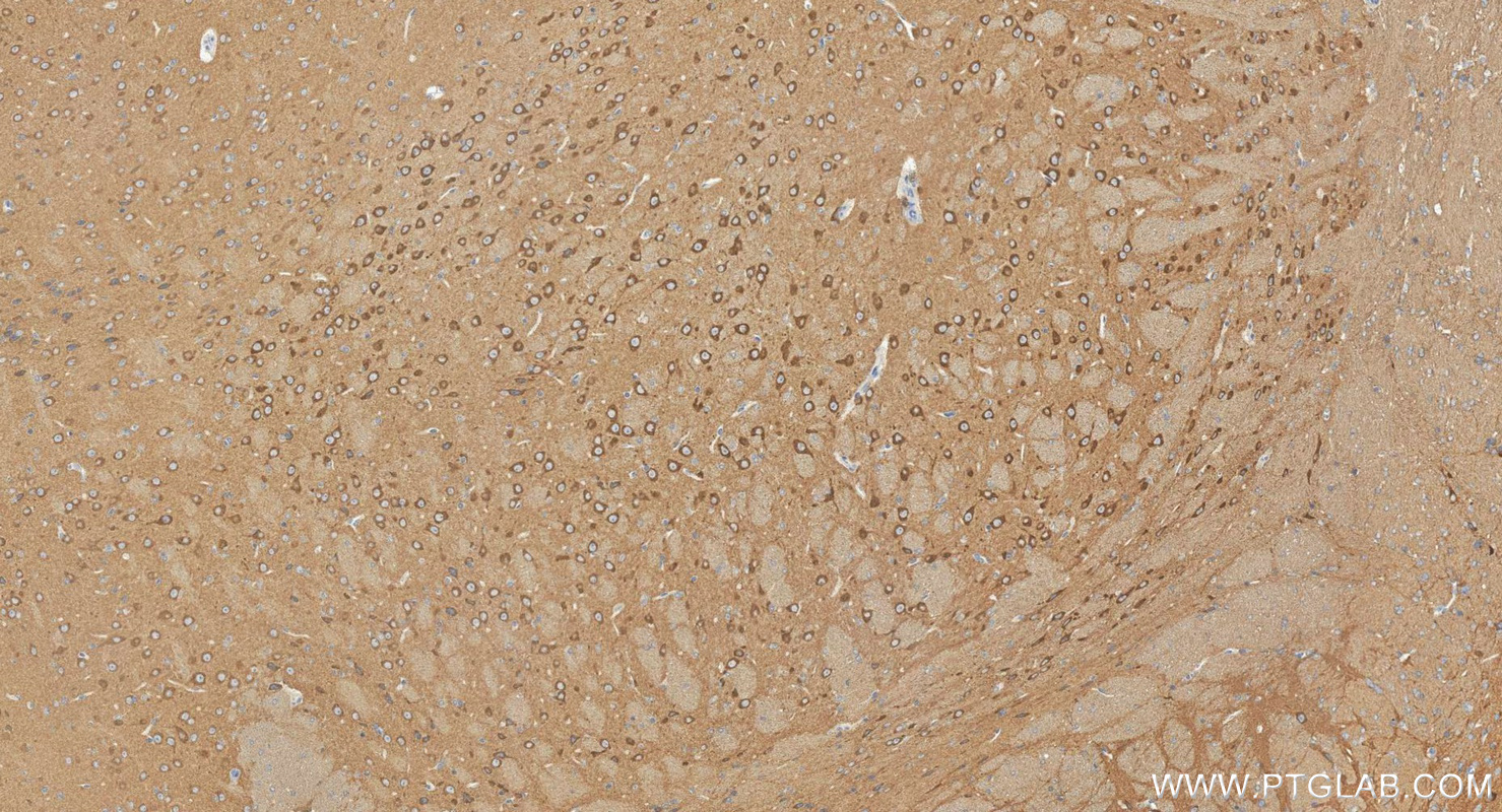 IHC staining of mouse brain using 24674-1-AP IHC staining of mouse brain using 24674-1-AP