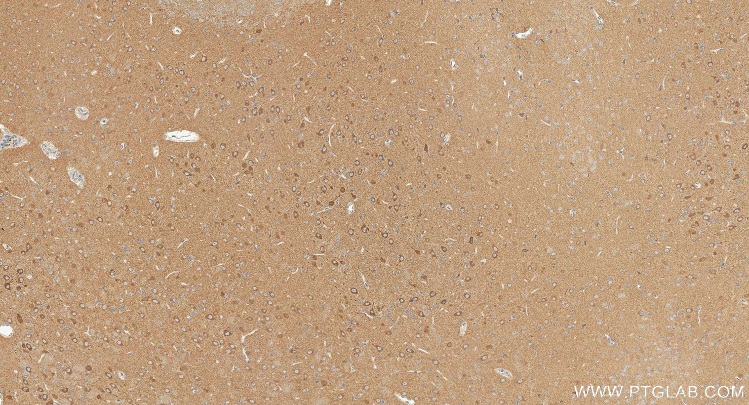 IHC staining of rat brain using 24674-1-AP IHC staining of rat brain using 24674-1-AP