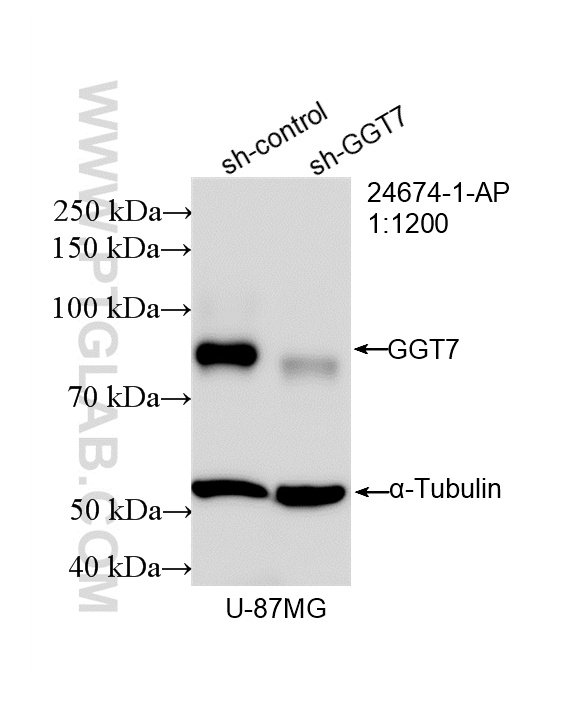 WB analysis of U-87 MG using 24674-1-AP WB analysis of U-87 MG using 24674-1-AP