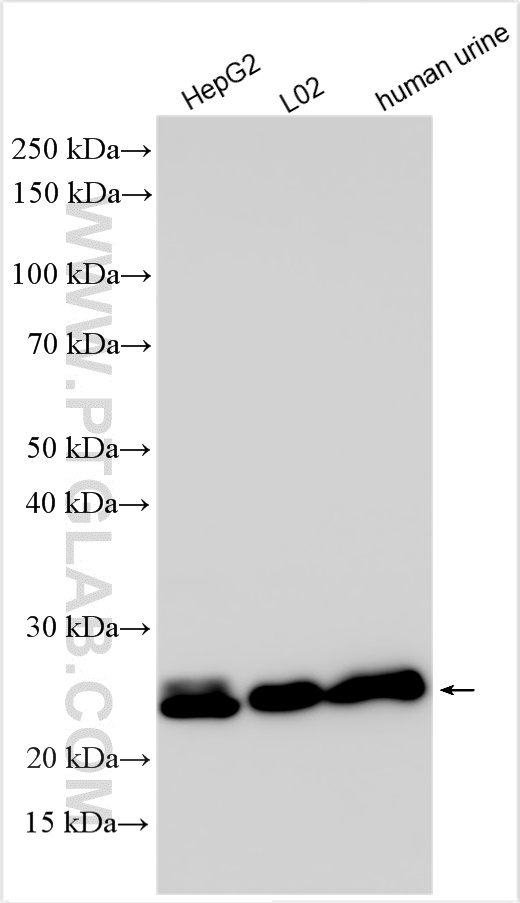 WB analysis using 83392-3-RR (same clone as 83392-3-PBS)