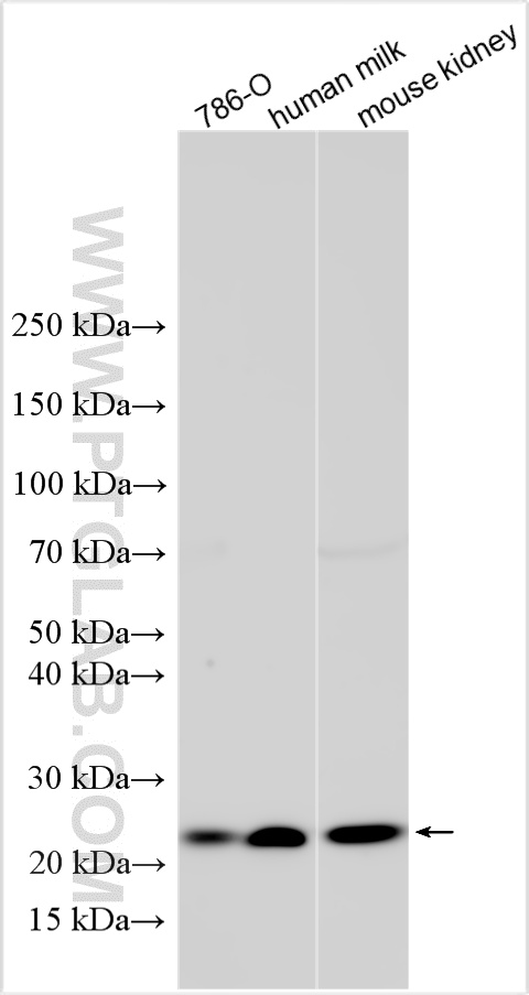 WB analysis using 18191-1-AP