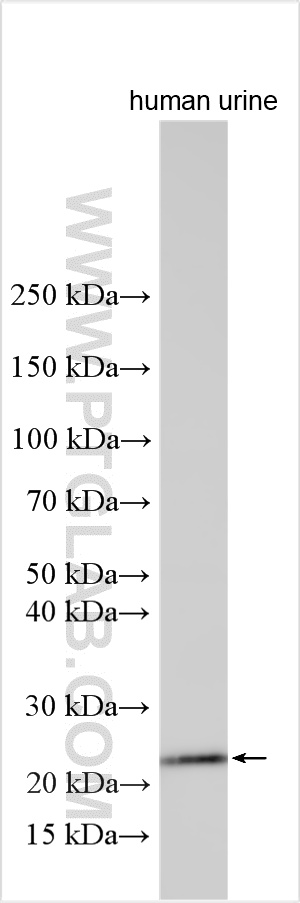 WB analysis using 18191-1-AP