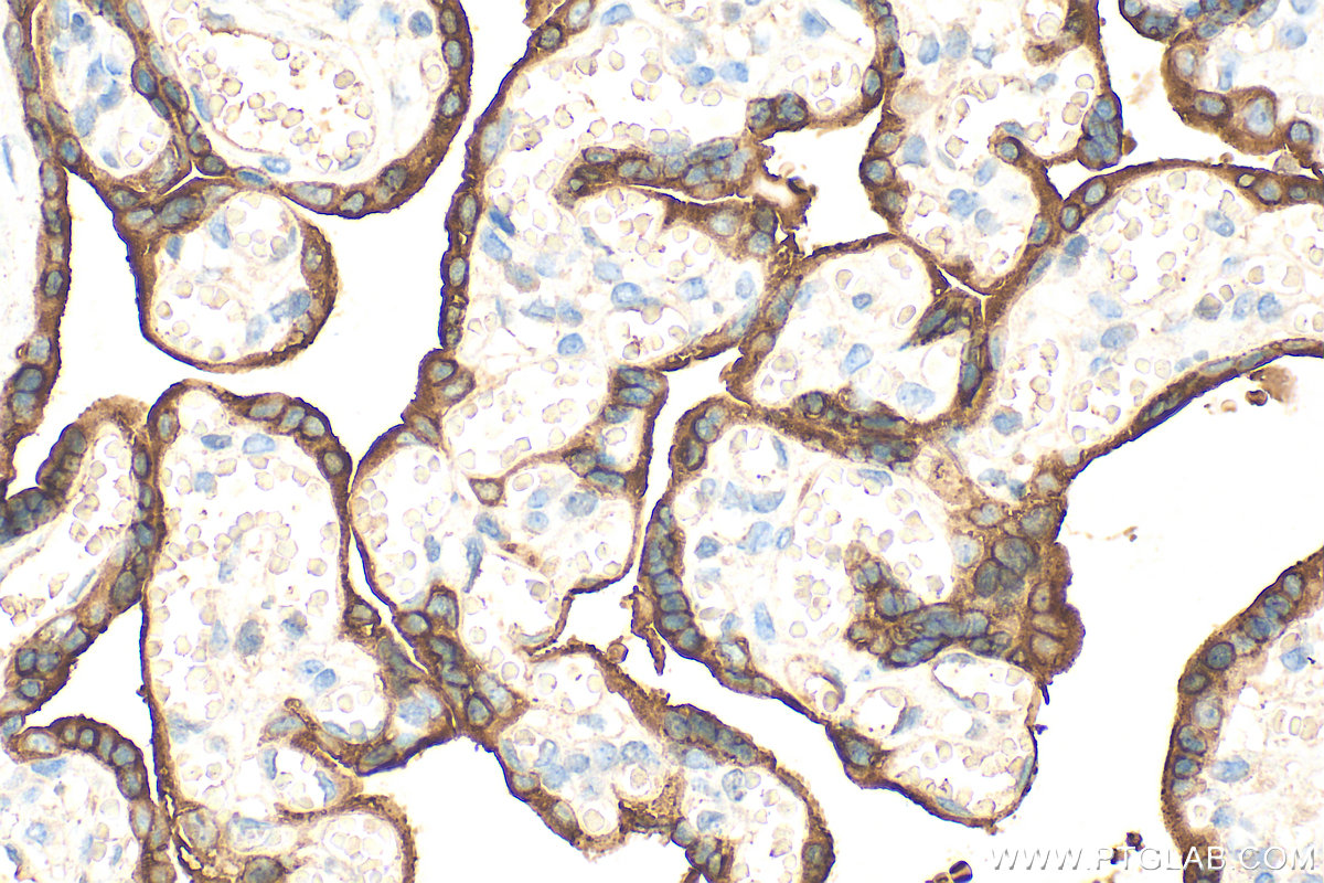 IHC staining of human placenta using 30345-1-AP