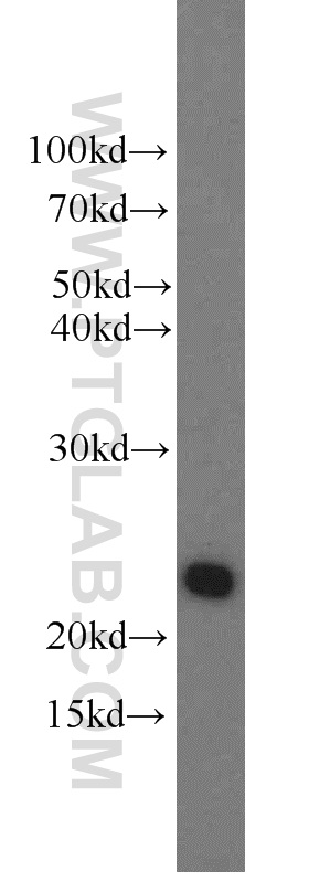 WB analysis of human placenta using 55243-1-AP