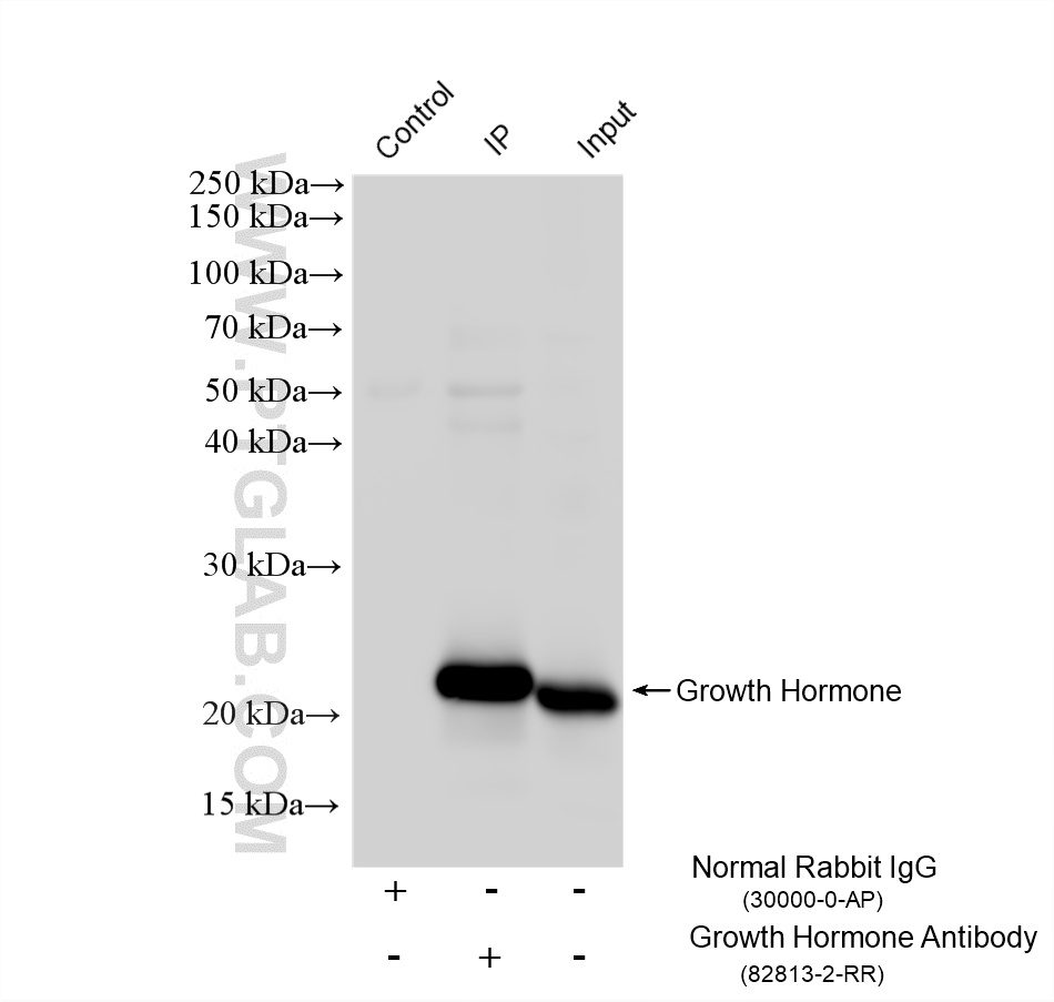 IP experiment of human placenta using 82813-2-RR