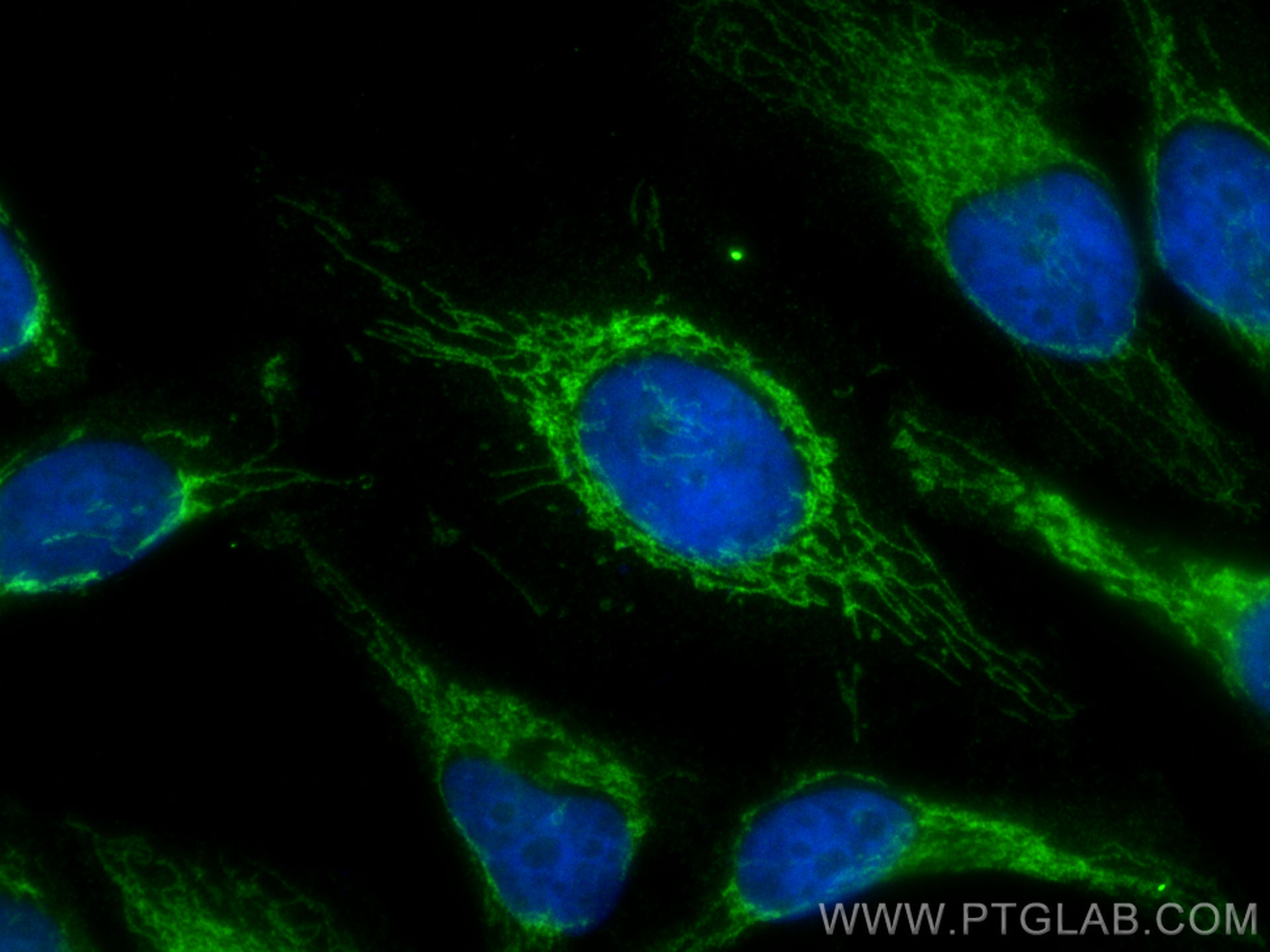 IF Staining of HeLa using 16296-1-AP