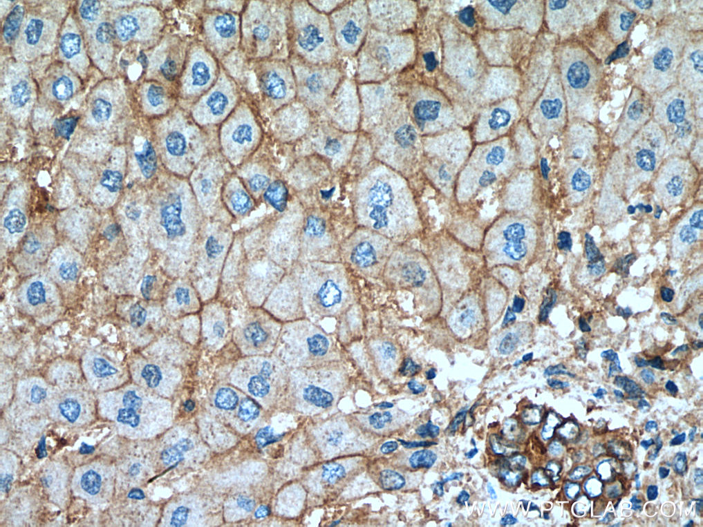 IHC staining of human liver using 20713-1-AP