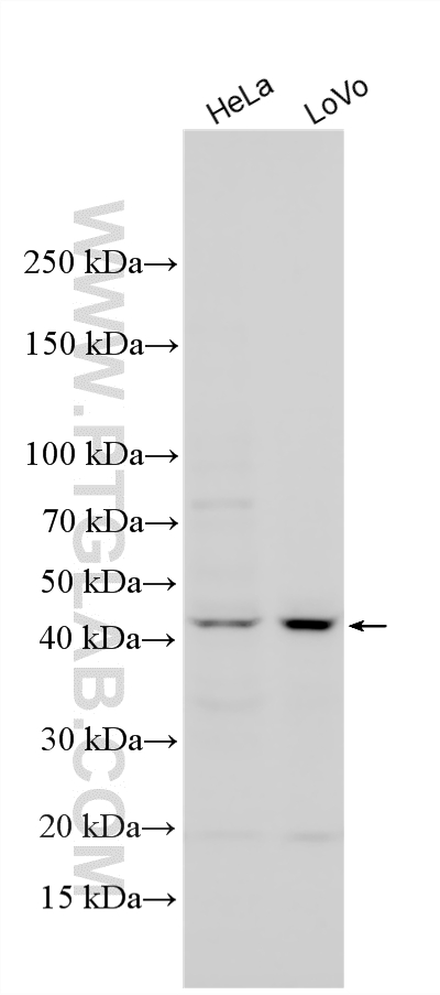 Various lysates were subjected to SDS PAGE followed by western blot with 20715-1-AP (GHRHR antibody) at dilution of 1:500 incubated at room temperature for 1.5 hours. WB analysis using 20715-1-AP
