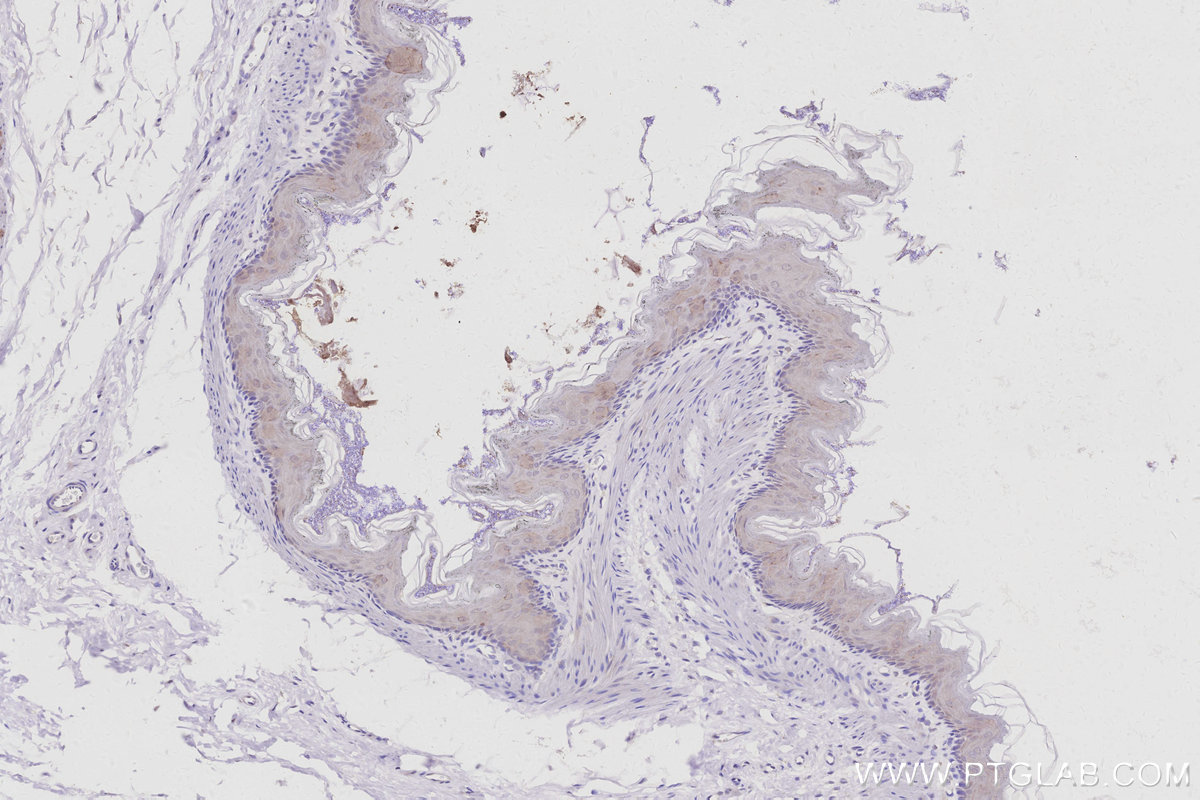 IHC staining of rat stomach using 13309-1-AP IHC staining of rat stomach using 13309-1-AP