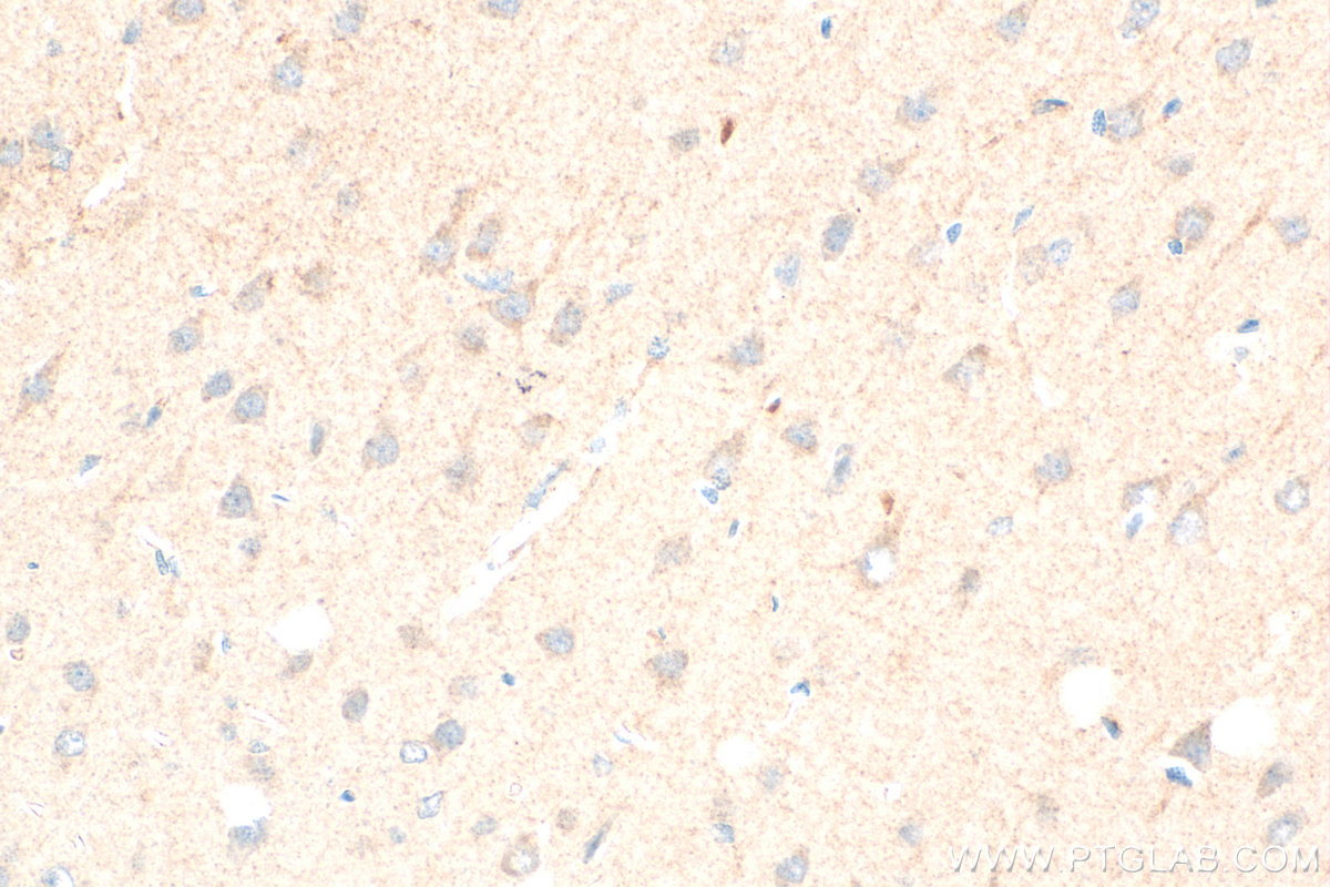 IHC staining of rat brain using 30602-1-AP