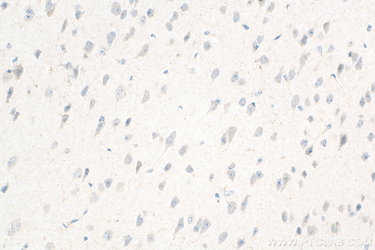IHC staining of mouse brain using 30602-1-AP