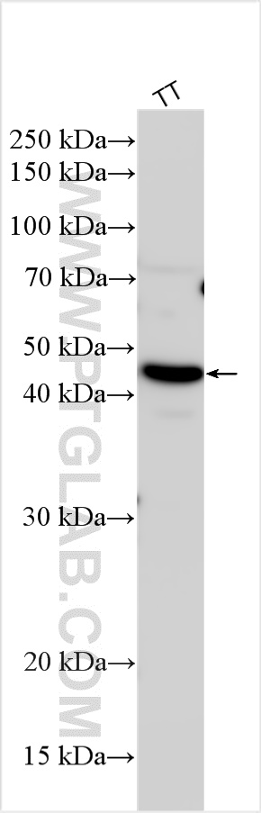 WB analysis using 30602-1-AP