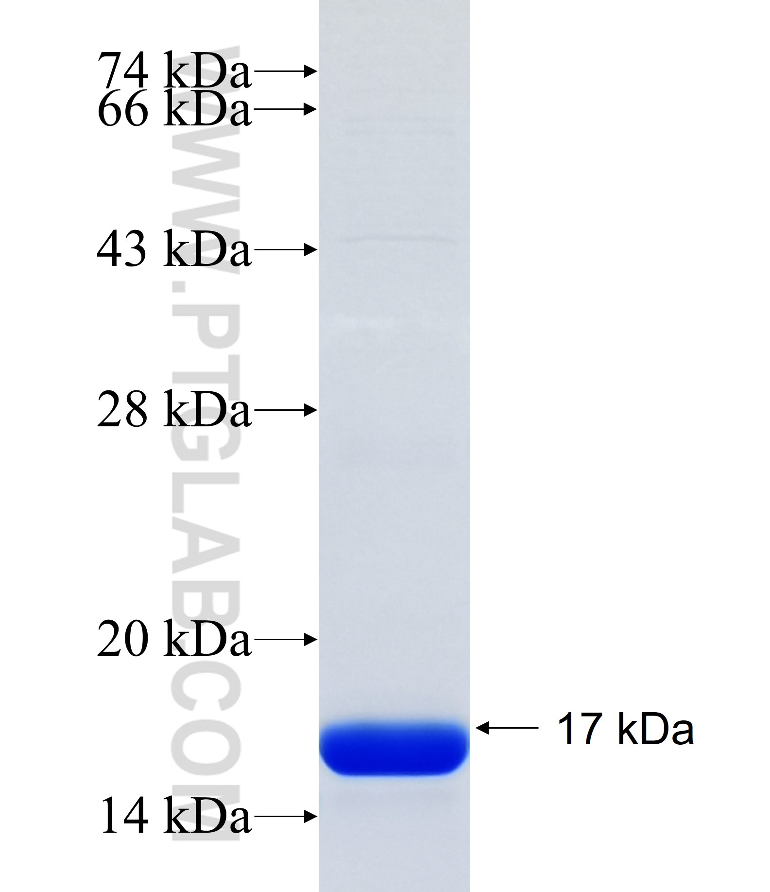 GIGYF1 fusion protein Ag34605 SDS-PAGE GIGYF1 fusion protein Ag34605 SDS-PAGE