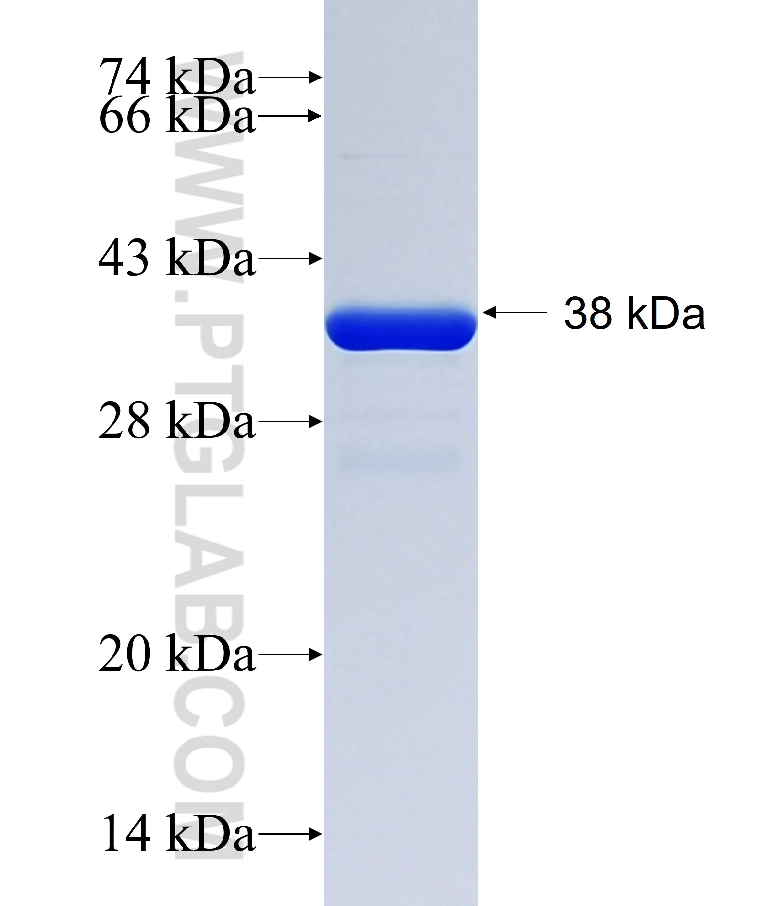 GIGYF1 fusion protein Ag34632 SDS-PAGE GIGYF1 fusion protein Ag34632 SDS-PAGE