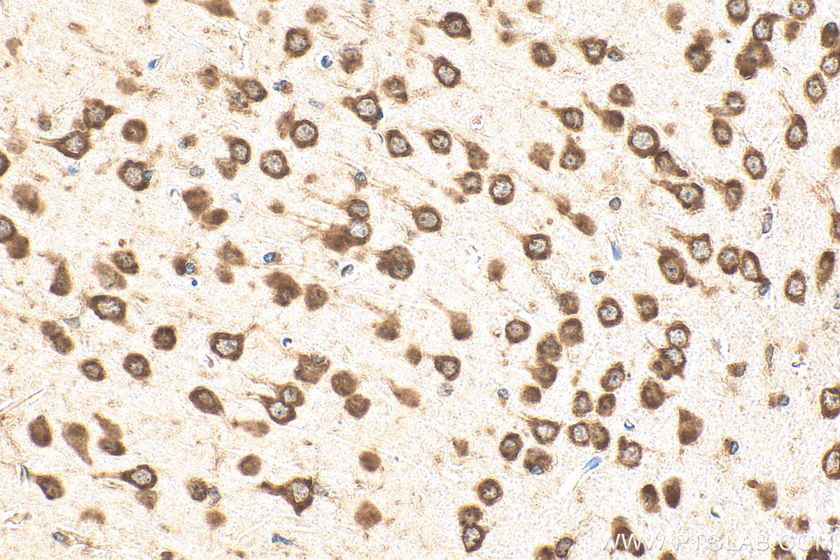 IHC staining of mouse brain using 24790-1-AP