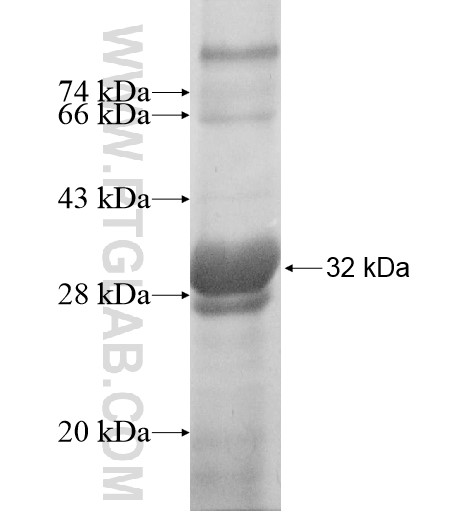 GIMAP1 fusion protein Ag11622 SDS-PAGE GIMAP1 fusion protein Ag11622 SDS-PAGE