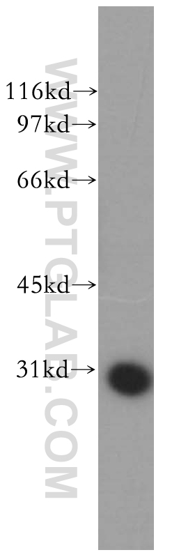 WB analysis of human heart using 13445-1-AP