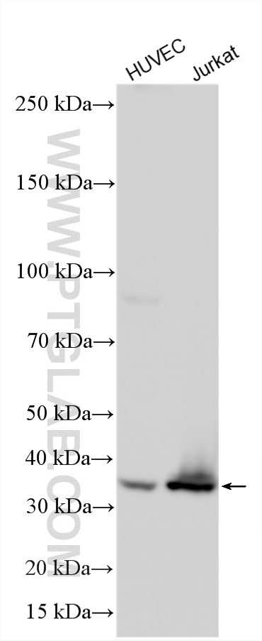 WB analysis using 33593-1-AP (same clone as 33593-1-PBS) WB analysis using 33593-1-AP (same clone as 33593-1-PBS)
