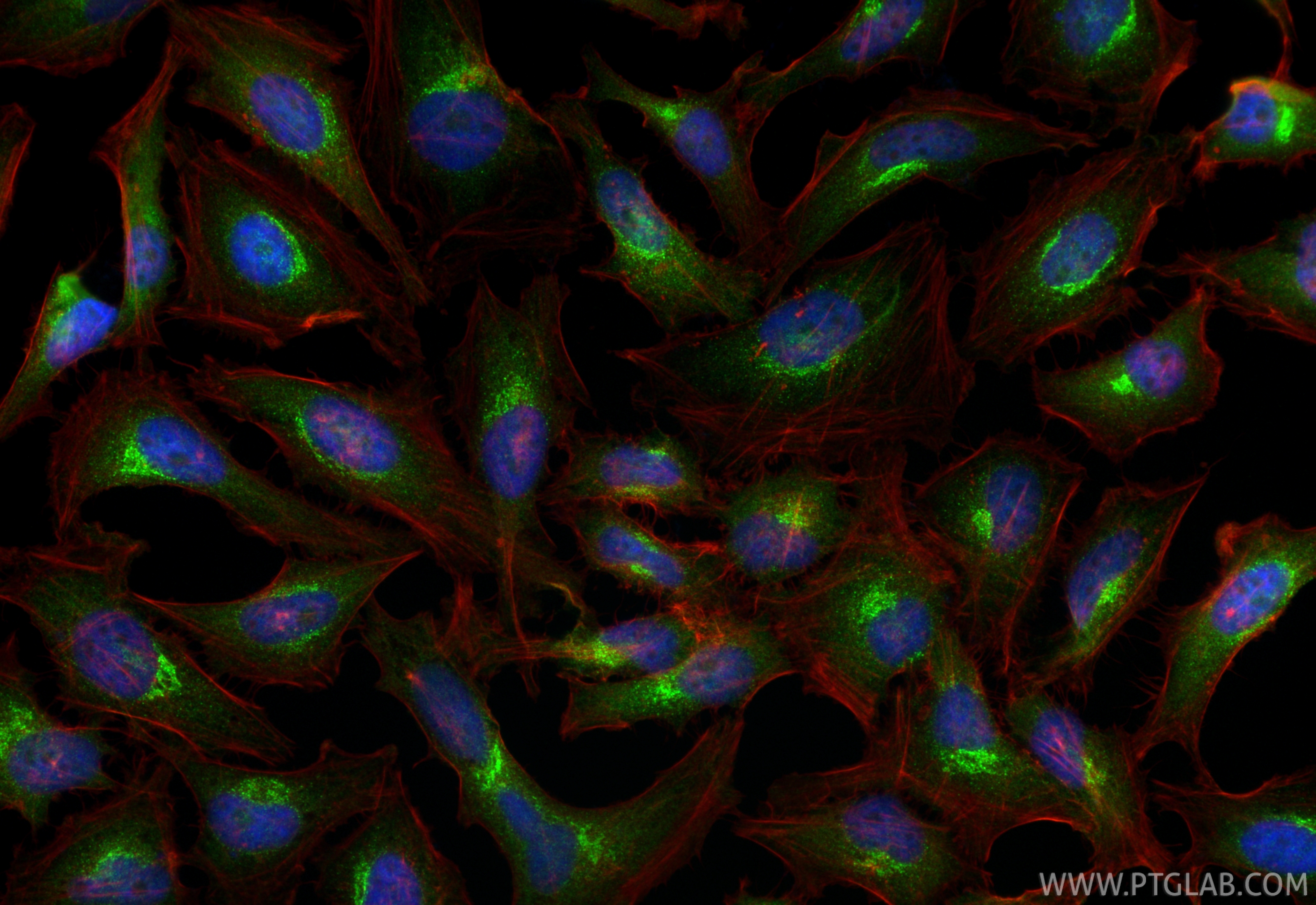 IF Staining of HeLa using 17293-1-AP IF Staining of HeLa using 17293-1-AP