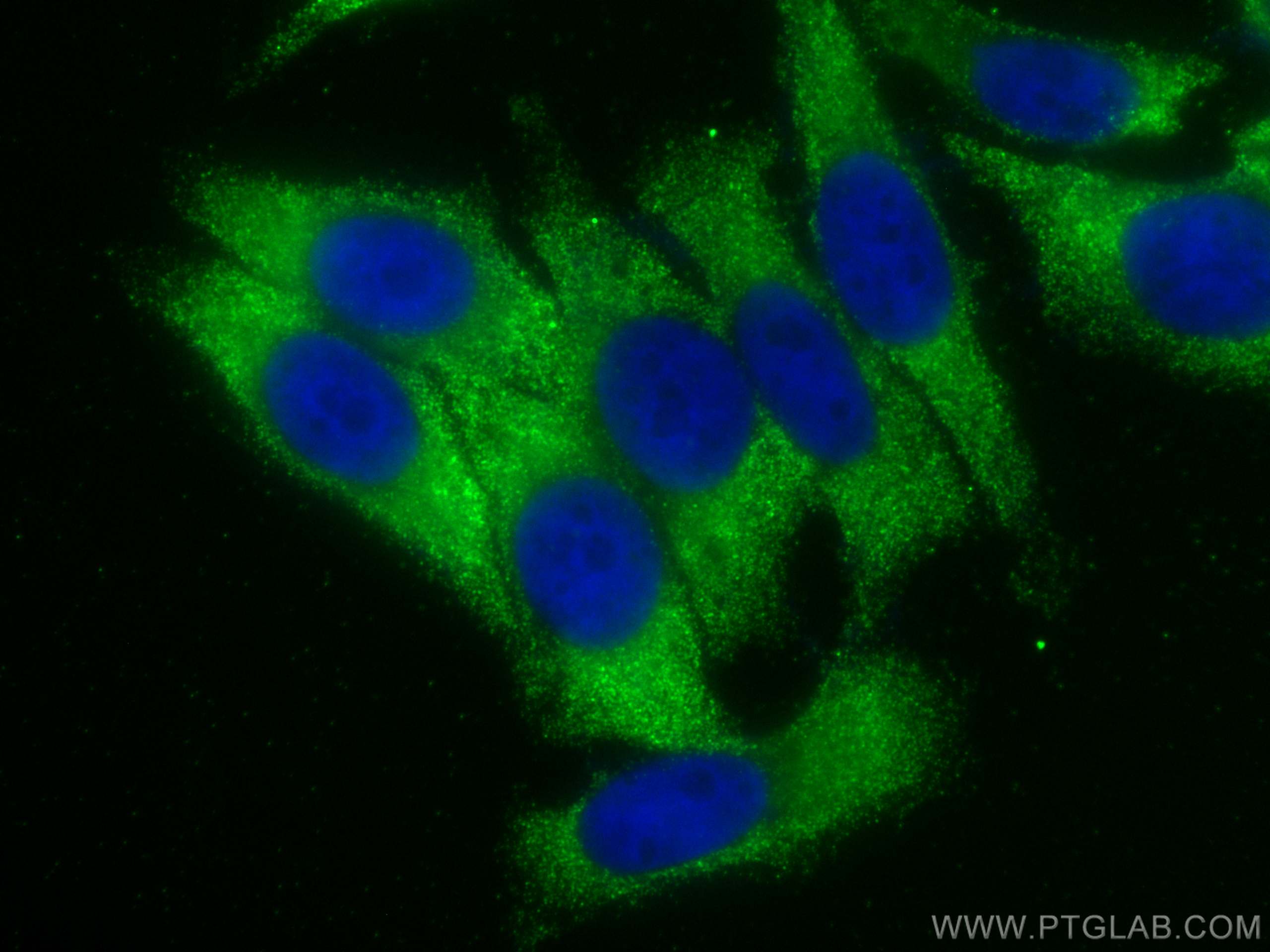 IF Staining of HepG2 using 68451-1-Ig (same clone as 68451-1-PBS)