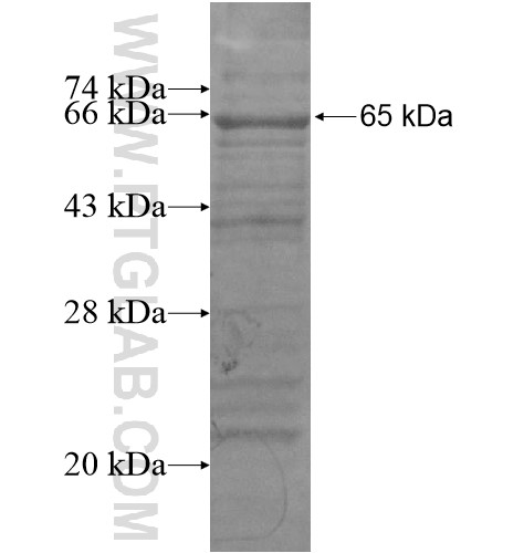 GIMAP8 fusion protein Ag15809 SDS-PAGE GIMAP8 fusion protein Ag15809 SDS-PAGE