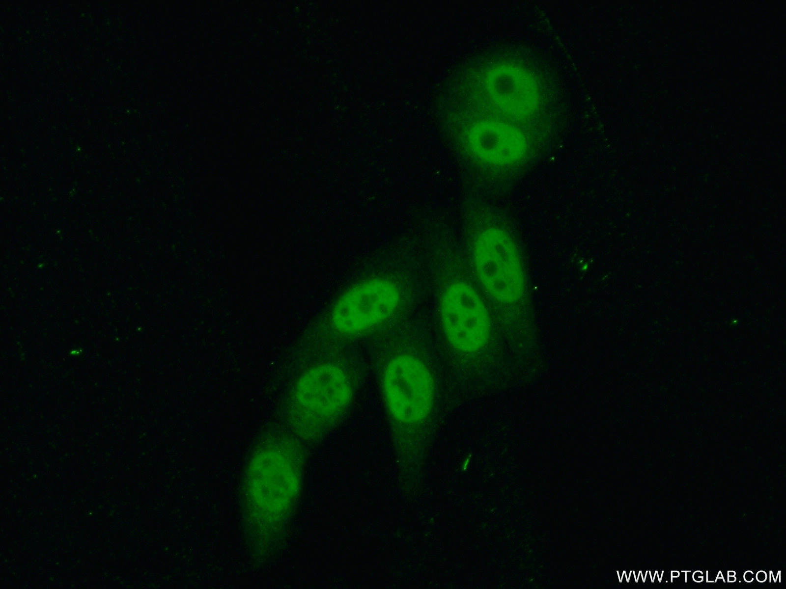 IF Staining of HepG2 using 16247-1-AP