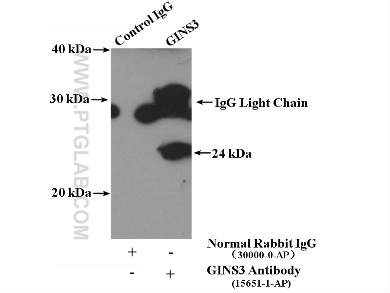 IP experiment of Jurkat using 15651-1-AP