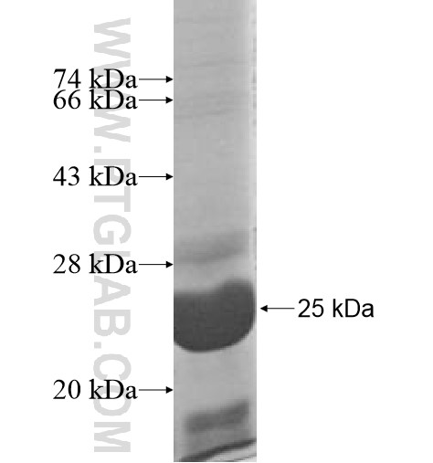GINS3 fusion protein Ag11102 SDS-PAGE GINS3 fusion protein Ag11102 SDS-PAGE