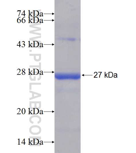 GINS3 fusion protein Ag9652 SDS-PAGE GINS3 fusion protein Ag9652 SDS-PAGE