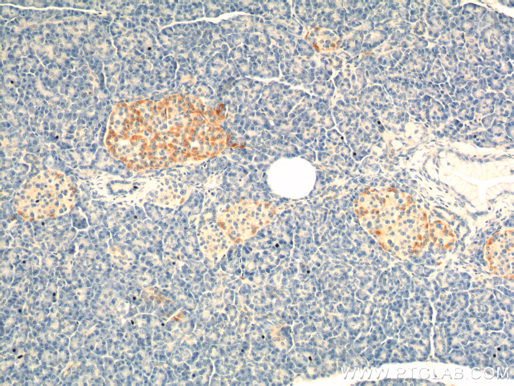 IHC staining of human pancreas using 18034-1-AP