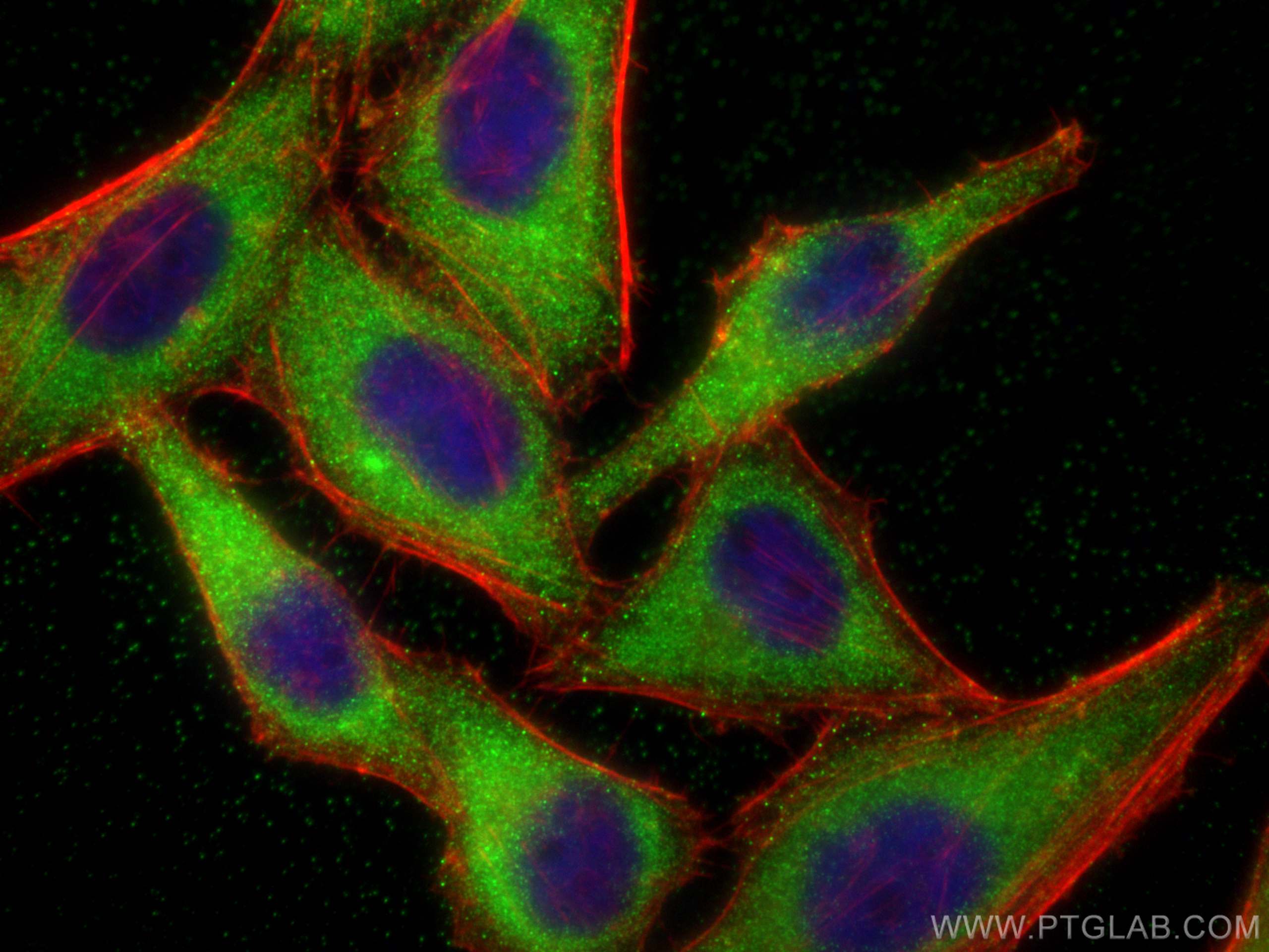 IF Staining of HepG2 using 14822-1-AP