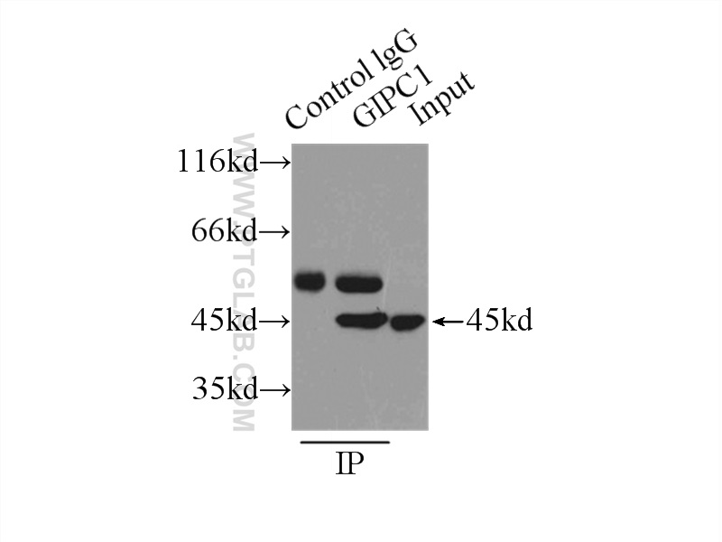 IP experiment of mouse brain using 14822-1-AP