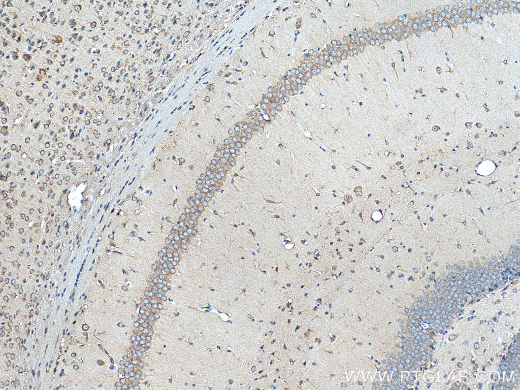 IHC staining of mouse brain using 28322-1-AP