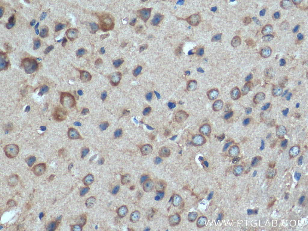 IHC staining of mouse brain using 28322-1-AP