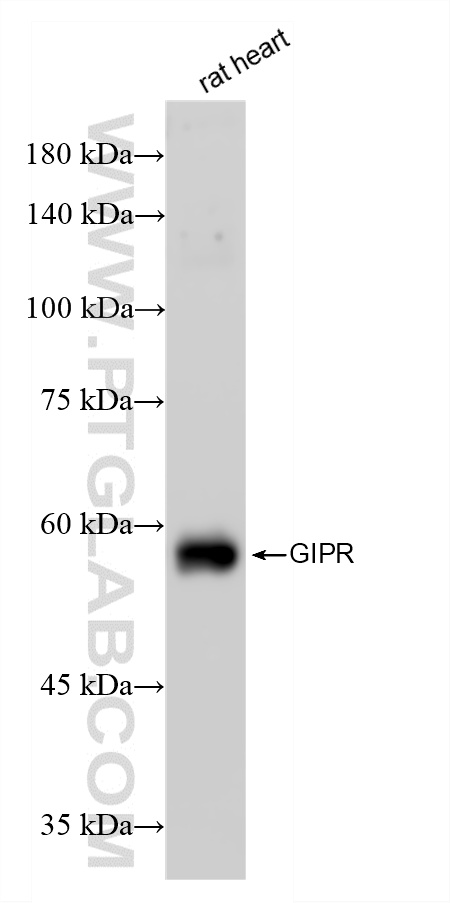 WB analysis using 87123-1-RR (same clone as 87123-1-PBS) WB analysis using 87123-1-RR (same clone as 87123-1-PBS)