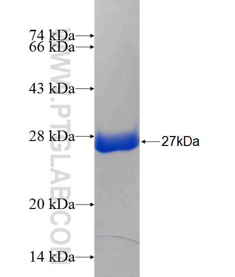 GIT1 fusion protein Ag24638 SDS-PAGE