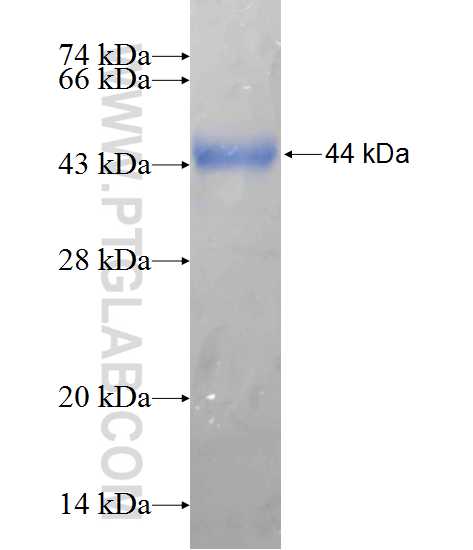 GIT1 fusion protein Ag10658 SDS-PAGE GIT1 fusion protein Ag10658 SDS-PAGE