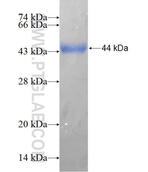 GIT1 fusion protein Ag10658 SDS-PAGE