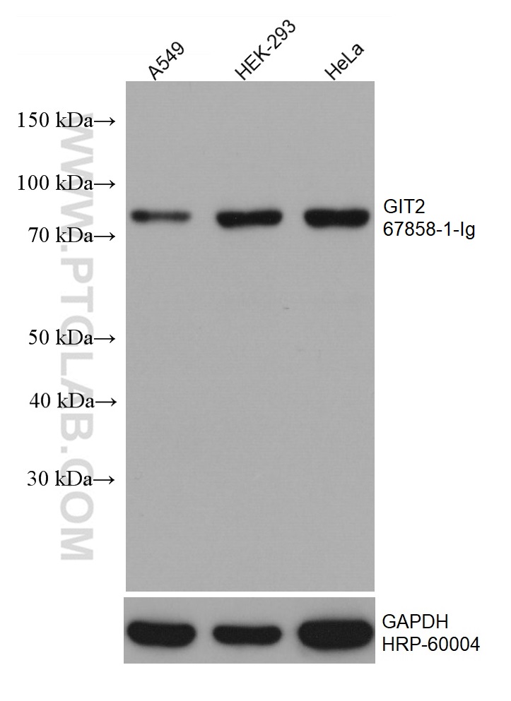 WB analysis using 67858-1-Ig