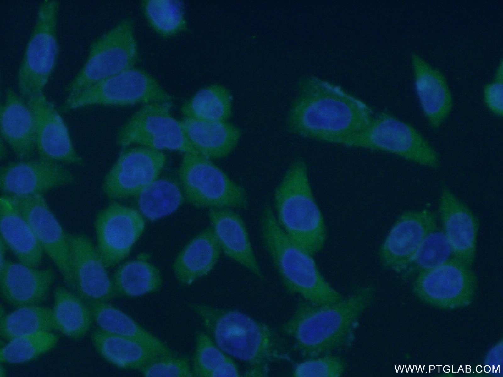 IF Staining of HeLa using 15386-1-AP